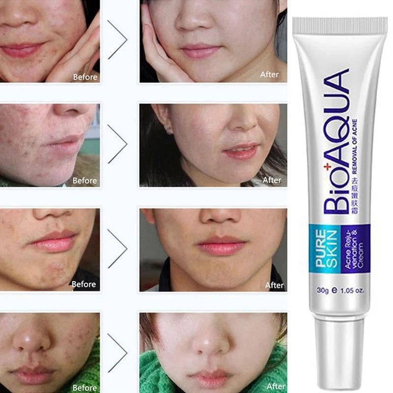 BioAqua Peach Exfoliating Gel||Peach Extract||Exfoliating Gel